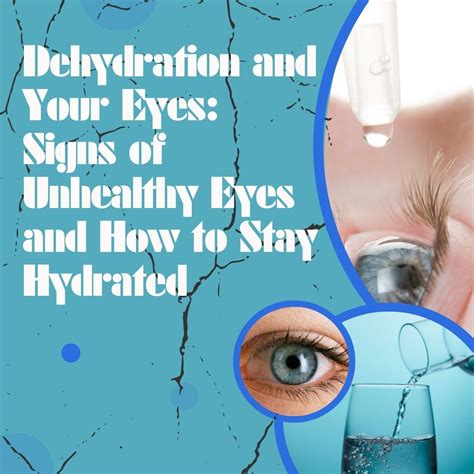 Dehydration And Your Eyes Signs Of Unhealthy Eyes And How To Stay Hydrated
