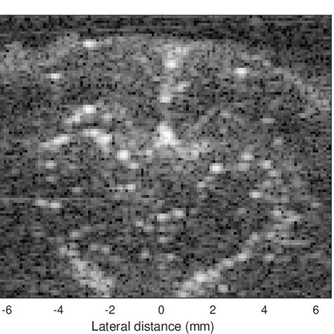 Example Of Rat Kidney Ultrasound Image With Microbubbles From The Pala