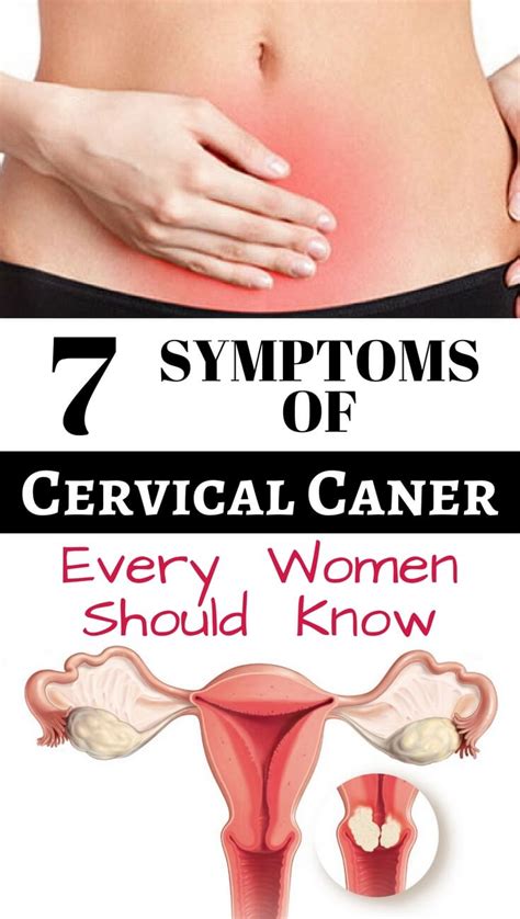 Signs Of Cervical Cancer 12 Warning Signs Of Cervical Cancer Every Woman Should Know