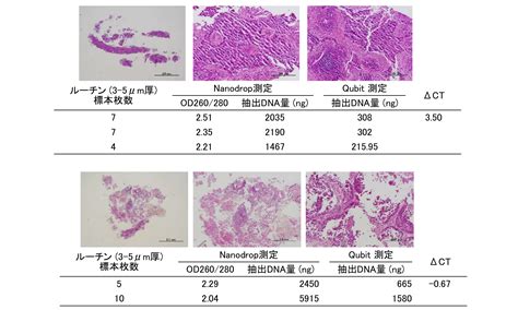 参考データ ① 実際のホルマリン固定パラフィン包埋標本 生検検体・手術検体から抽出できるゲノムdnaの量と質 一般社団法人 日本