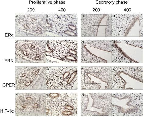 Oestrogen Receptors And Hypoxia Inducible Factor Alpha Expression In