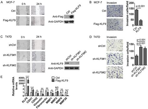 Figure From Kr Ppel Like Factor Upregulates E Cadherin