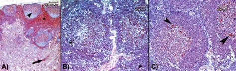 A Distribution Of Cd3 Positive Cells Within The Lymph Follicle Download Scientific Diagram