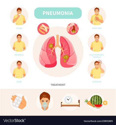 Pneumonia Infographic Royalty Free Vector Image