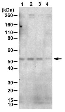 Anti Phospho Parkin Ser65 Purified Antibody From Rabbit Sigma Aldrich