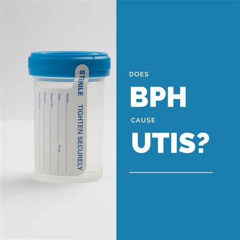 Does Bph Cause Utis New York City 1 Prostate Center