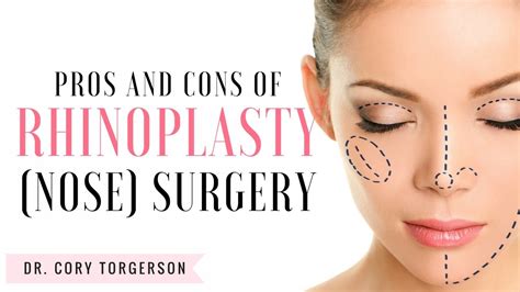 Pros And Cons Of Nose Surgery Rhinoplasty Youtube