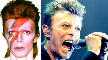 David Bowie Morre Aos Anos De Idade