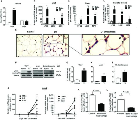 Macrophage Depletion Increases Tissue Ne Infiltration Male Lysm Cre