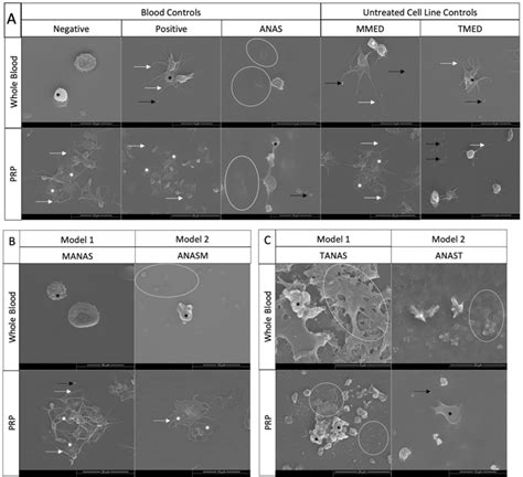 Representative Scanning Electron Micrographs Showing Whole Blood And
