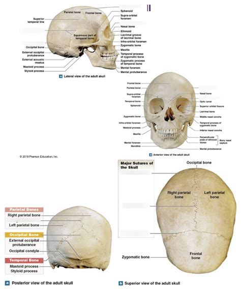 sutures of the skull Diagram | Quizlet