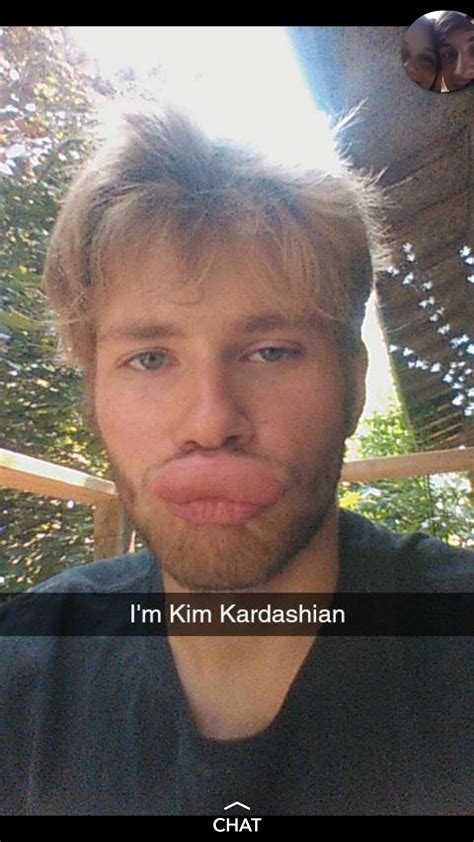 Friends lip got stung by a wasp : r/funny