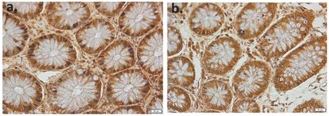 Applied Sciences Free Full Text Immunohistochemical Expression