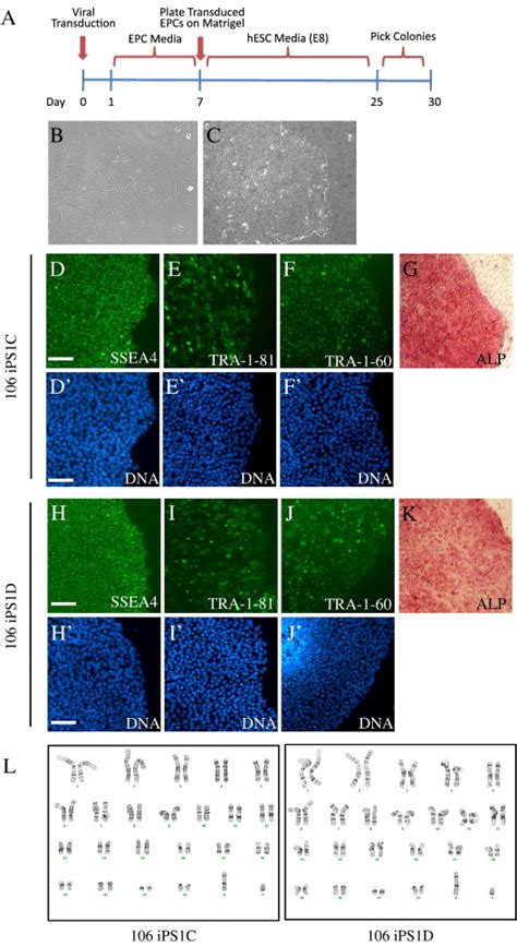 EPC Derived IPSCs Express Pluripotent Markers And Retain Normal