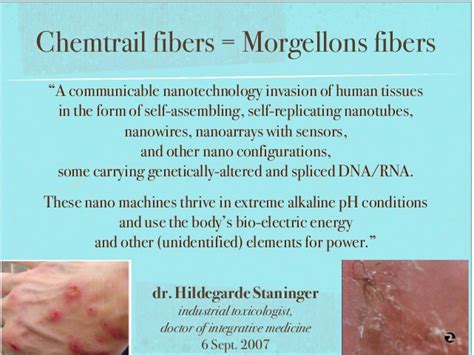 Nano Parasites Morgellons On Your Mask And Swab Of Pcr Test Space Traveler In Alabama