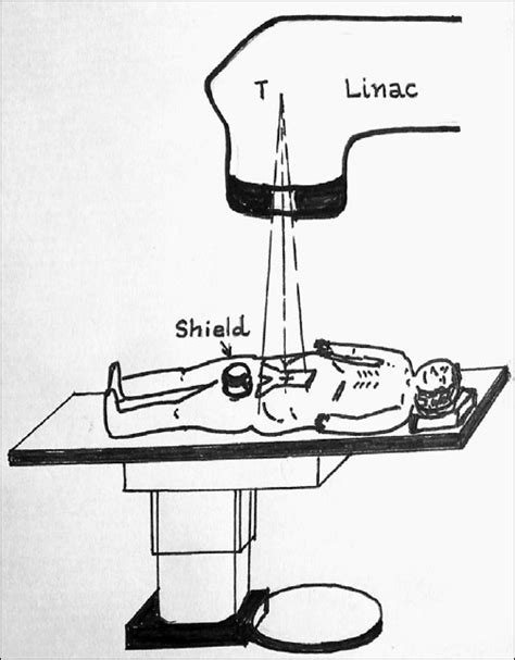 The Relationship Of The Gonadal Shield With Respect To The Inverted