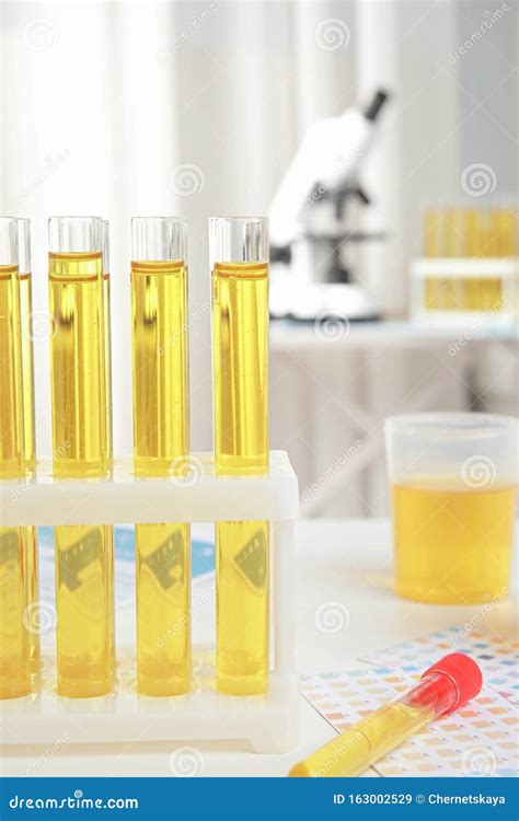 Test Tubes With Urine Samples For Analysis On Table In Laboratory Stock