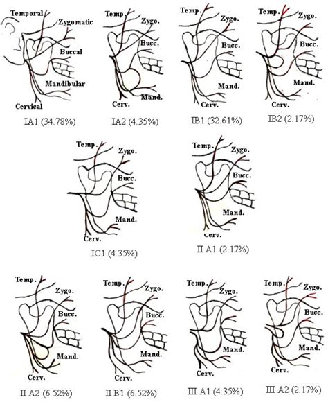 New Classification Of Branching Pattern Of Facial Nerve During Parotidectomy A Cross Sectional