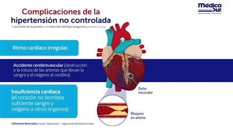 Complicaciones de la hipertensión no controlada YouTube