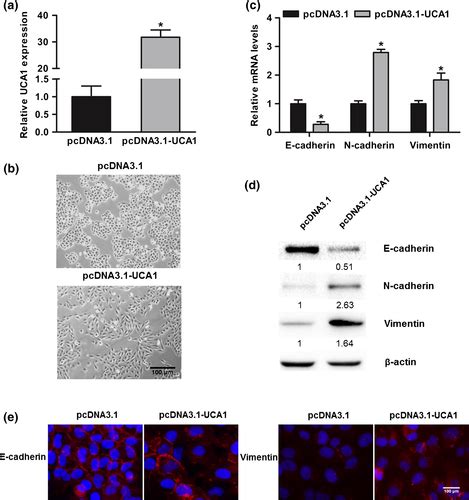 Long Noncoding Rna Urothelial Cancerassociated Promotes Bladder