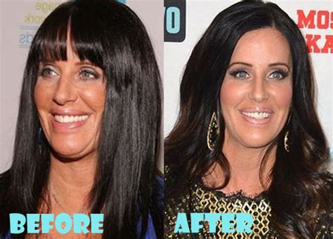 Patti Stanger Plastic Surgery Before and After Pictures - Lovely Surgery