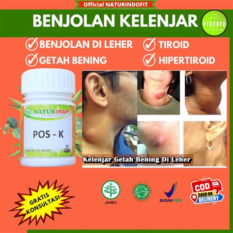 Jual Obat Tiroid Hipertiroid Kelenjar Getah Bening Limfoma Benjolan