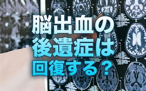 脳出血の意識レベルと回復について 再生医療脳梗塞・脊髄損傷の後遺症を幹細胞治療で改善ニューロテックメディカル