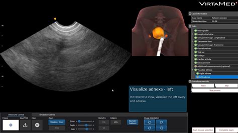 Virtamed Gynos™ Transvaginal Obstetric Ultrasound Simulator Youtube