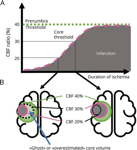 Figure Core And Penumbra Thresholds As Function Of Duration Of Ischemia