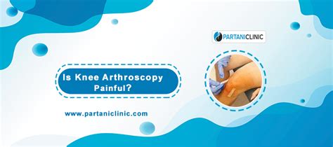 Is Knee Arthroscopy Painful Dr Arun Partani Knee Surgeon