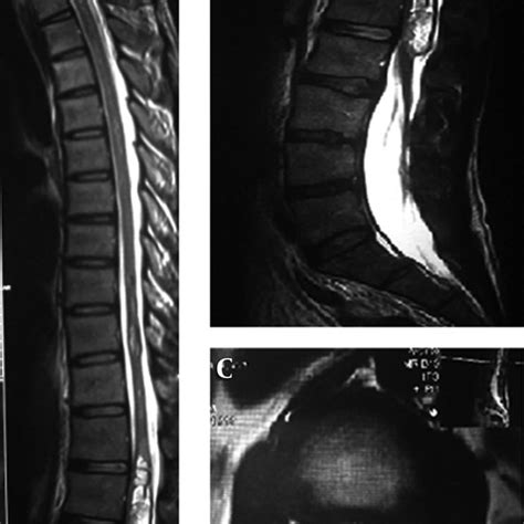 Preoperative Magnetic Resonance Imaging Download Scientific Diagram