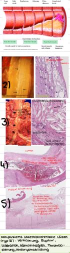 Herz Kreislauf Pathologie Karteikarten Quizlet