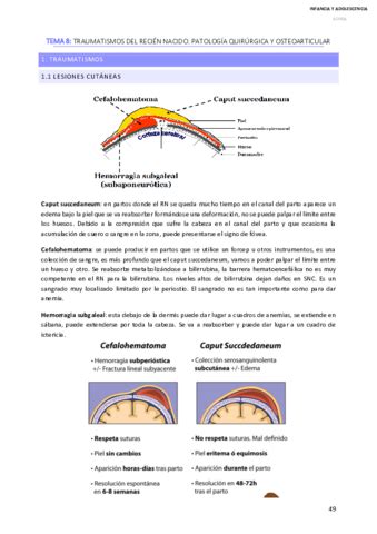 TEMA 8 INFANCIA Pdf