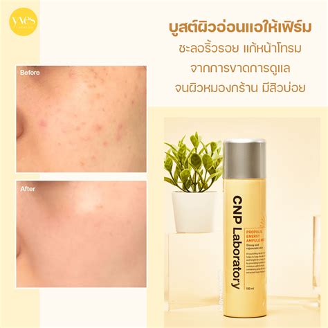 Cnp Laboratory Propolis Energy Ampule Mist Yvescosmetic