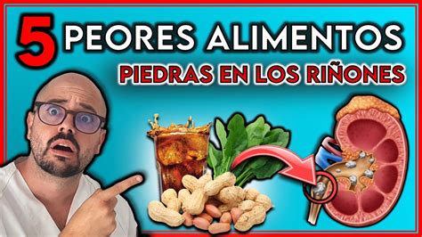 Alimentos Que Producen Piedras En Los Ri Ones Evitalos Si Tienes