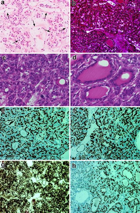 Photomicrographs Showing Histological And Immunohistochemical Findings