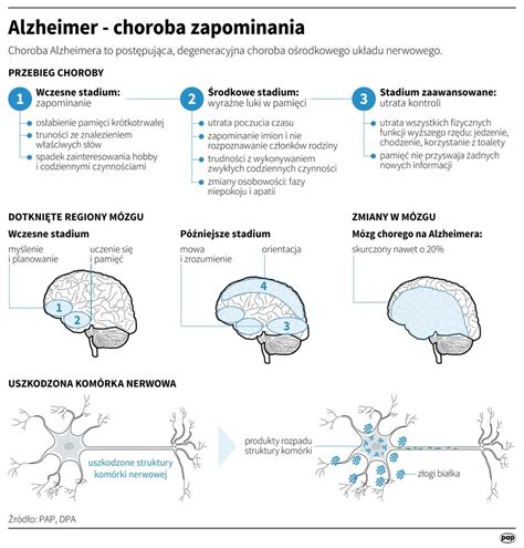 Ta choroba mózgu dotyka najwięcej Polaków Twojezdrowie pl