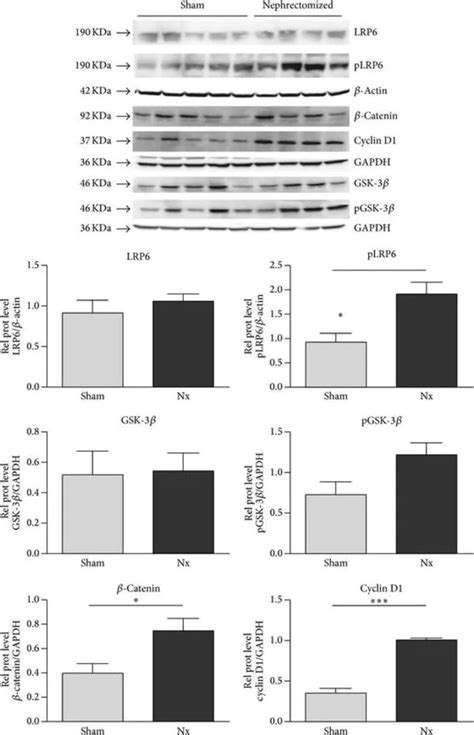 抗 Cyclin D1单克隆抗体 小鼠抗Monoclonal Anti Cyclin D1 antibody produced in mouse