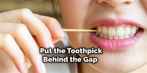 How To Close A Gap In Your Teeth Without Braces In 12 Steps 2025