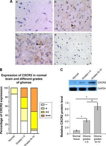 Full Article Correlation Of C X C Chemokine Receptor 2 Upregulation