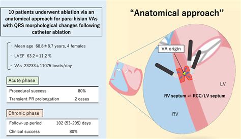 Anatomical Approach To Suppression Of Para Hisian Ventricular