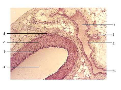 Muscular Artery Vs Elastic Artery Histology