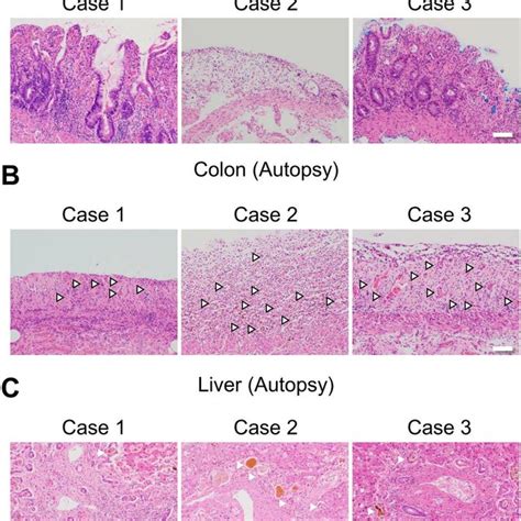 Pdf Ischemia Induced Intestinal De Epithelization And Consequent