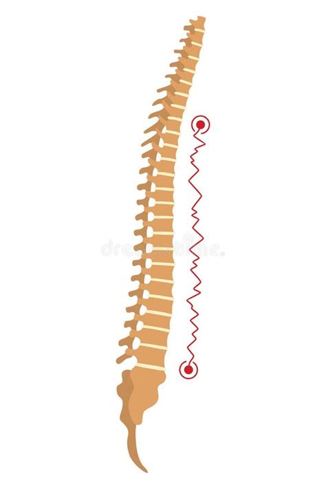 Spinal Deformity Symbol Of Spine Curvatures Or Unhealthy Backbones