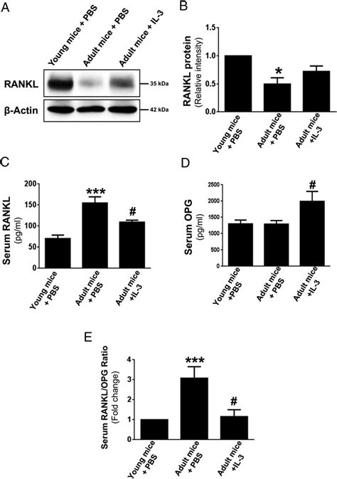 In Vivo Role Of Il On Regulation Rankl Opg Ratio In Adult Mice Adult