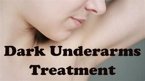 Dark Underarms Treatment Natural Treatment To Get Rid Of Dark