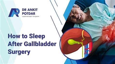 How To Sleep After Gallbladder Surgery A Comprehensive Guide