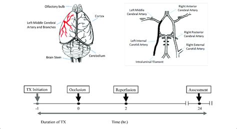 Cerebral Artery Occlusion Pathophysiology - mapasgmaes