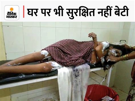 Acid Attack On Brother And Sister In Rae Bareli When The Girl Did Not