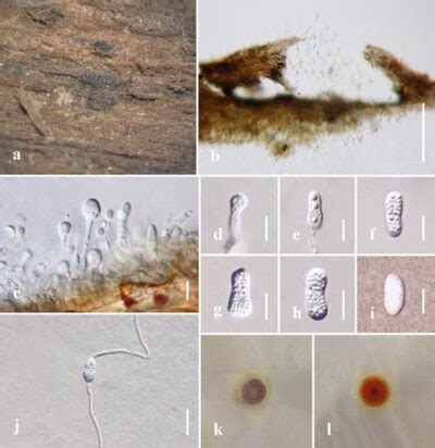 Clohesyomyces Aquaticus Facesoffungi Number Fof Faces Of Fungi